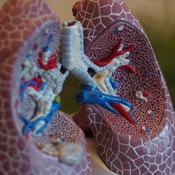 EarlyCDT Lung Cancer Screening