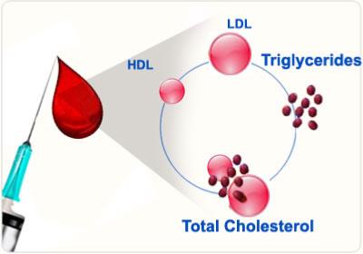 Cholesterol risk assessment 