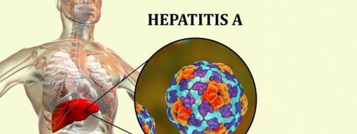 Hepatitis A Profile