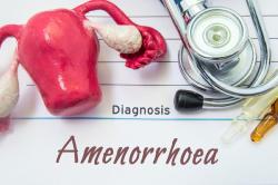 Amenorrhoea Profile