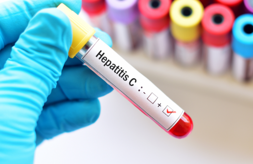 Hepatitis C Antibodies
