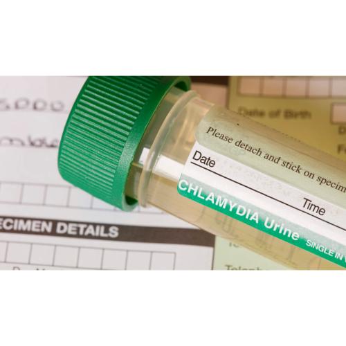 Fast STI Urine/Blood Screening