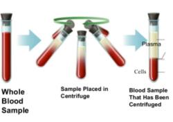 Blood Sample Centrifuging & Freezing 
