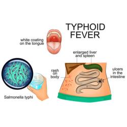 Typhoid Vaccine (TYPHIM Vi)