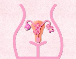 Polycystic Ovary Syndrome Profile (comprehensive) - Fasting Required