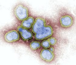 Influenza A and B 2 Flu Screening