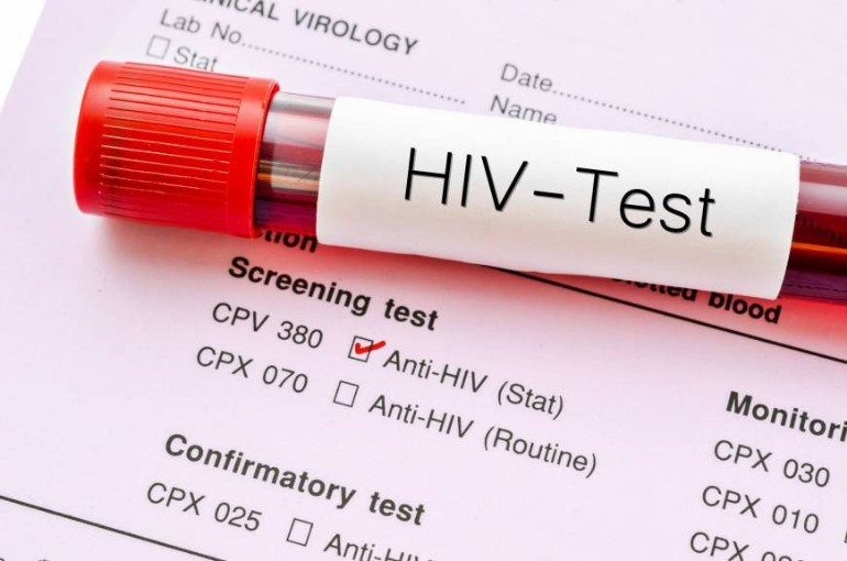 HIV (human immunodeficiency virus) - With Visa Requirements. 